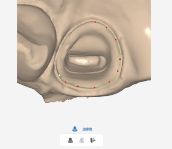 Rapid 3 Intraoral Scanner